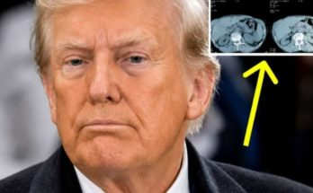 Trump MRI scan results
