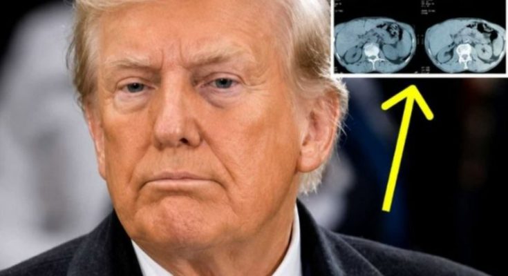 Trump MRI scan results